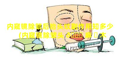 内窥镜除皱后抬头纹副作用知多少(内窥镜除皱头 🐅 麻 ☘ 木多久能恢复)